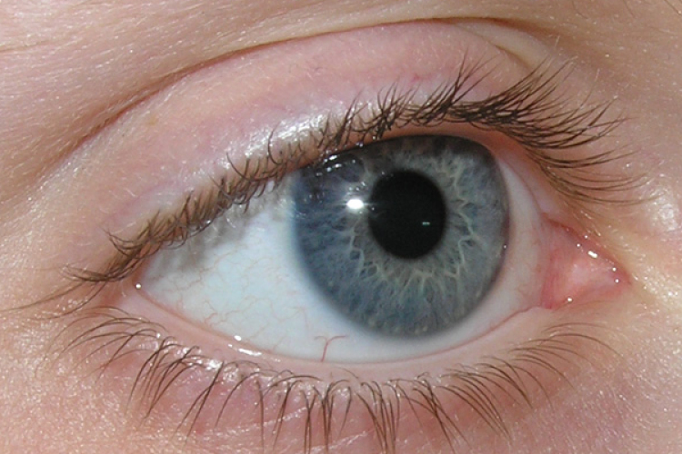 Mi köze a pajzsmirigynek a szembetegségekhez?