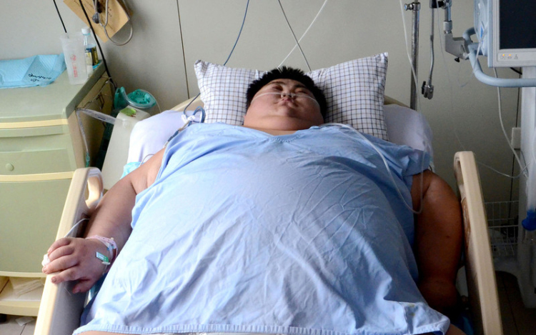 Meghalt Kína legkövérebb, 300 kilogrammos embere