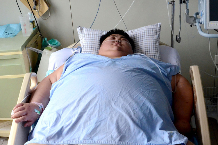 Meghalt Kína legkövérebb, 300 kilogrammos embere