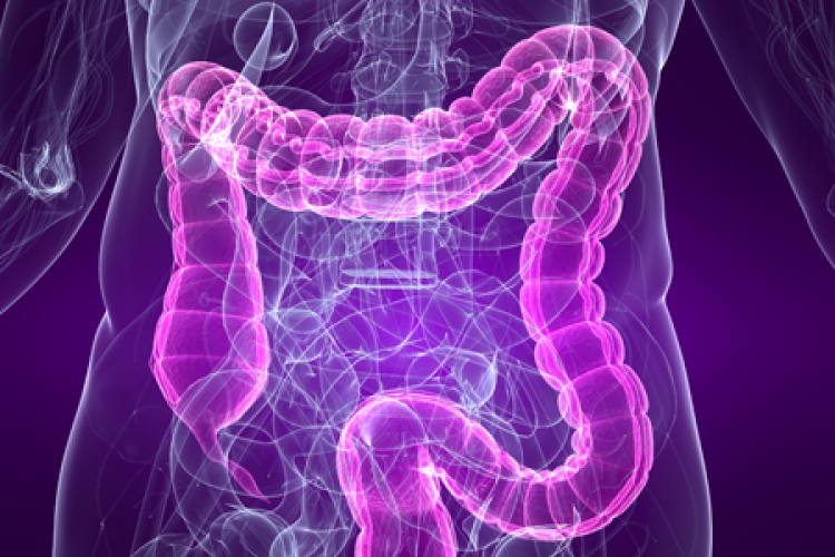 Hogyan előzhető meg a vastagbélrák? 