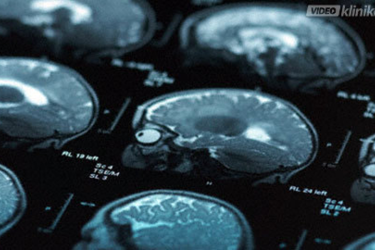 Fejben dől el a krónikus fájdalom