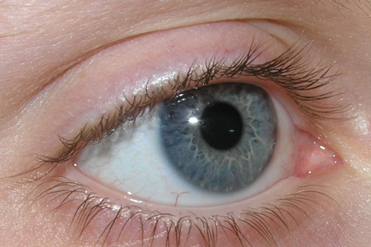 A vak anyák gyermekei élesebben látnak 